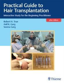 Practical Guide to Hair Transplantation : Interactive Study for the Beginning Practitioner