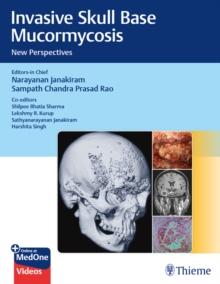 Invasive Skull Base Mucormycosis : New Perspectives