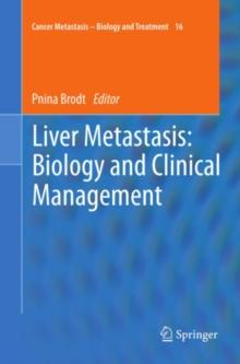 Liver Metastasis: Biology and Clinical Management