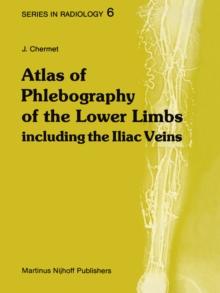 Atlas of Phlebography of the Lower Limbs : Including the Iliac Veins