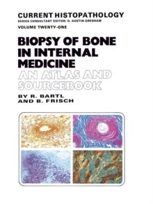 Biopsy of Bone in Internal Medicine: An Atlas and Sourcebook