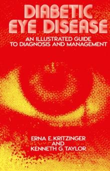 Diabetic Eye Disease : An Illustrated Guide to Diagnosis and Management