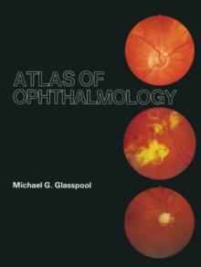 Atlas of Ophthalmology