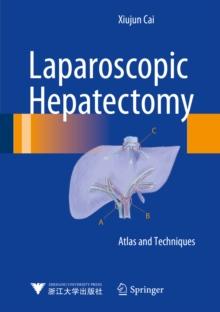 Laparoscopic Hepatectomy : Atlas and Techniques