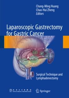 Laparoscopic Gastrectomy for Gastric Cancer : Surgical Technique and Lymphadenectomy