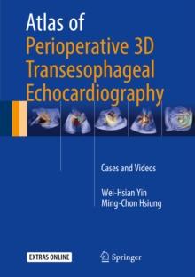 Atlas of Perioperative 3D Transesophageal Echocardiography : Cases and Videos