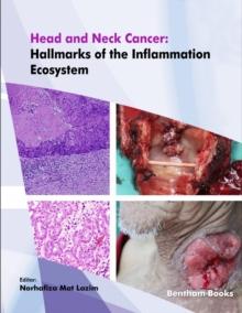 Head and Neck Cancer: Hallmarks of the Inflammation Ecosystem