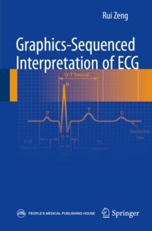 Graphics-sequenced interpretation of ECG