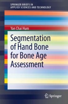 Segmentation of Hand Bone for Bone Age Assessment