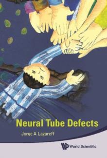 Neural Tube Defects