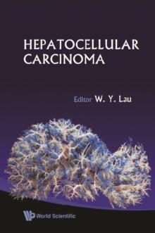 Hepatocellular Carcinoma