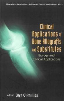 Clinical Applications Of Bone Allografts And Substitutes: Biology And Clinical Applications