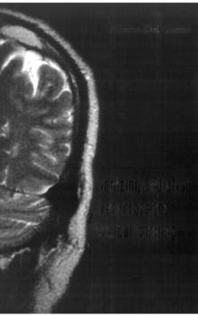 Ionizing Radiation Detectors For Medical Imaging