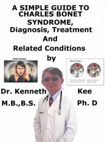 Simple Guide to Charles Bonnet Syndrome, Diagnosis, Treatment and Related Conditions