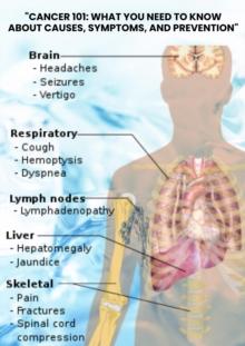 "Cancer 101: What You Need to Know About Causes, Symptoms, and Prevention"