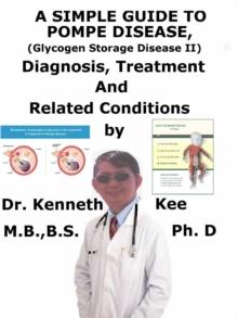 Simple Guide to Pompe Disease (Glycogen Storage Disease II), Diagnosis, Treatment and Related Conditions