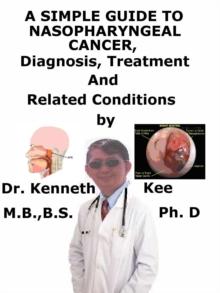 Simple Guide to Nasopharyngeal Cancer, Diagnosis, Treatment, and Related Conditions