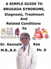 Simple Guide to Brugada Syndrome, Diagnosis, Treatment and Related Conditions