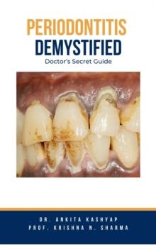 Periodontitis Demystified: Doctor's Secret Guide