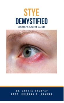 Stye Demystified: Doctor's Secret Guide