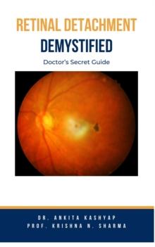 Retinal Detachment Demystified: Doctor's Secret Guide