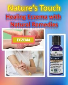 Nature's Touch Healing Eczema with Natural Remedies