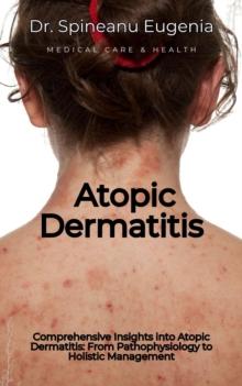 Atopic Dermatitis: From Pathophysiology to Holistic Management