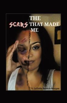 THE SCARS THAT MADE ME