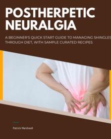 Postherpetic Neuralgia : A Beginner's Quick Start Guide to Managing Shingles Through Diet, With Sample Curated Recipes