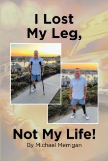 I Lost My Leg, Not My Life!