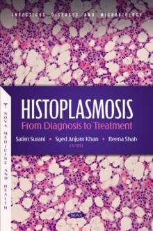 Histoplasmosis: From Diagnosis to Treatment