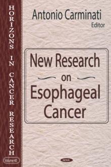 New Research On Esophageal Cancer