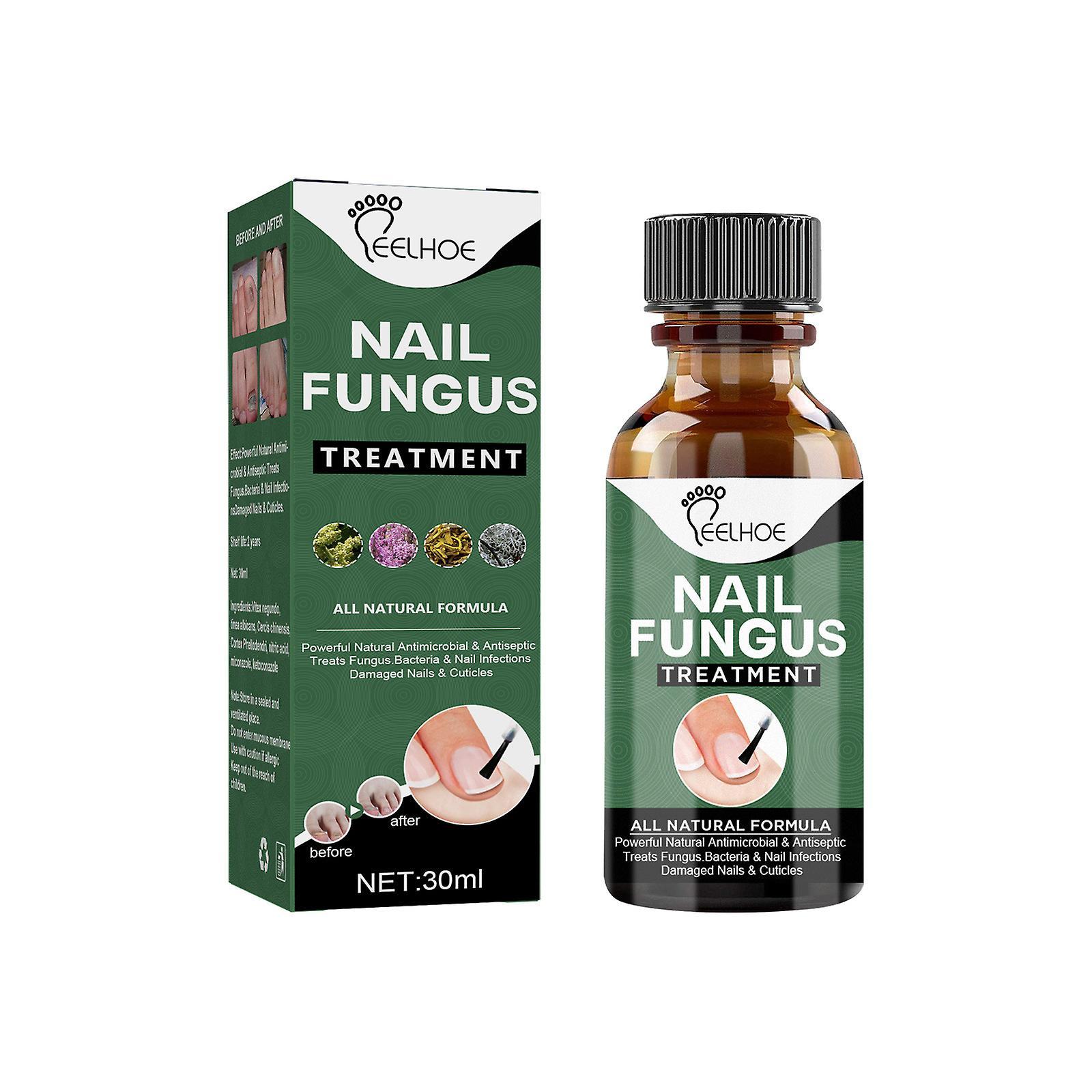 Fruushop Extra Strength Nail Repair Fluid Toenail And Nail Solution Toenails And Nails Repair Damaged And Discolored Nails 1Pcs