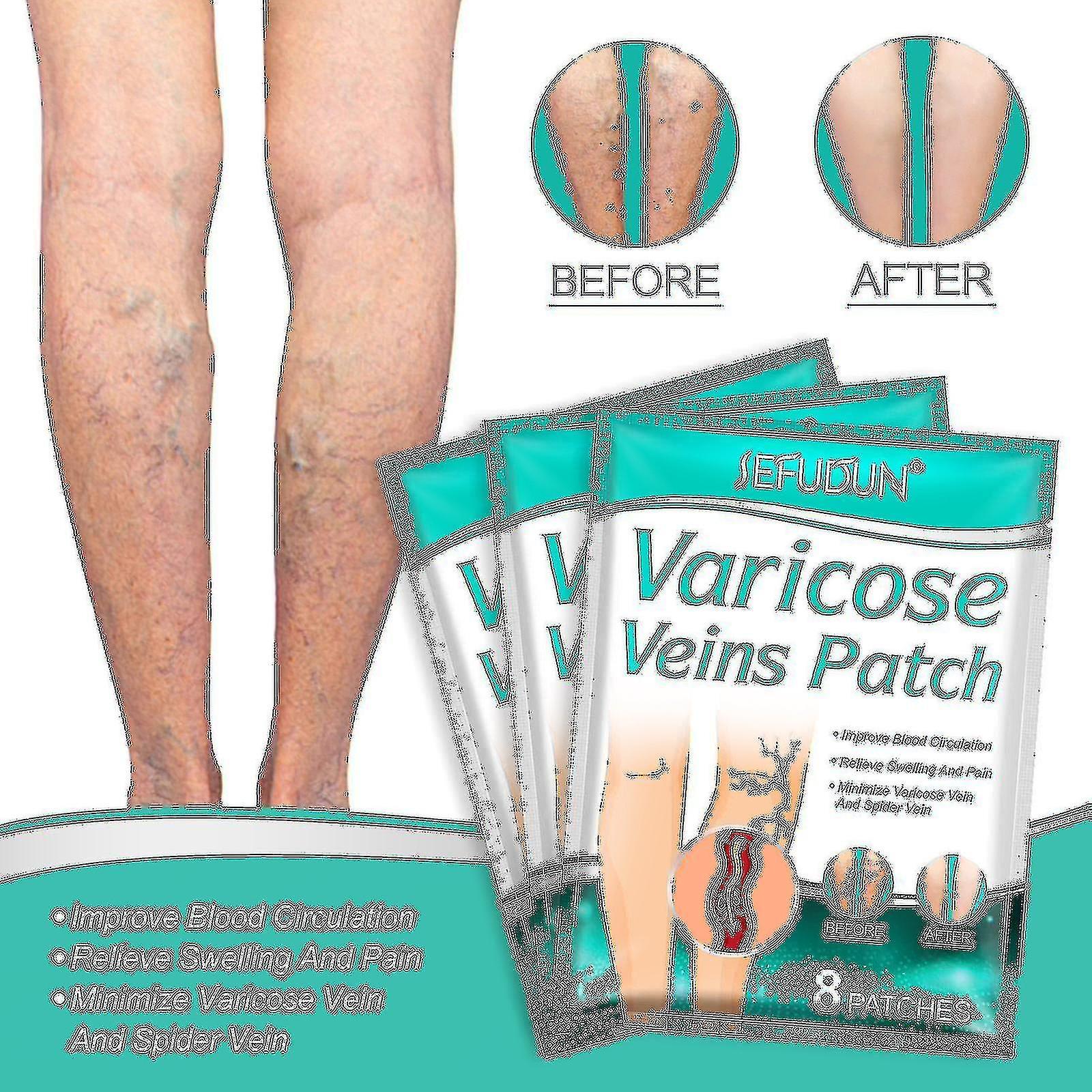 Htclv Varicose Veins Patch Relief Leg Vasculitis Spider Varicose Vein Patches Varicose Veins For Legs Improve Blood Foot Health Care 24pcs