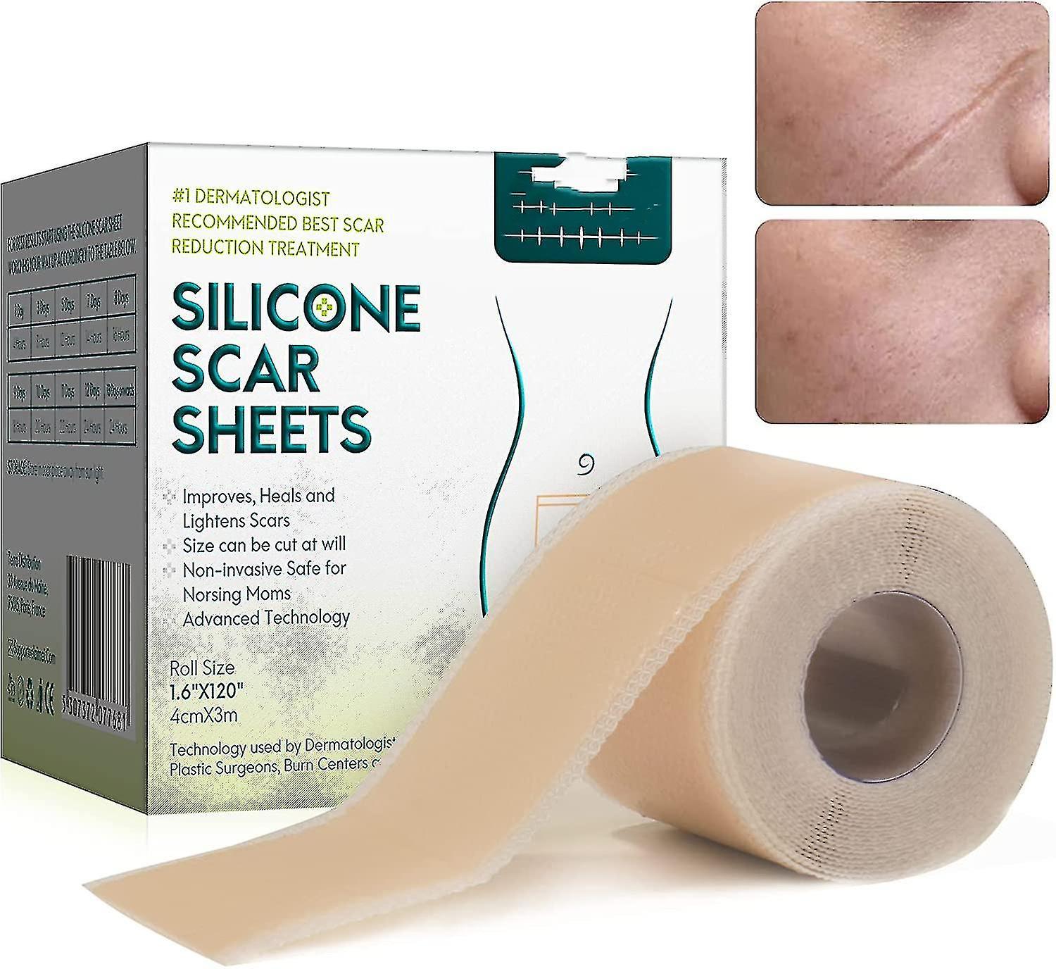 Qilk Silicone Plasters For Scars, Silicone Scar Films For Surgeries, Caesarean Section, Keloids, Burns,silicone Scar Tape-4cm*3m