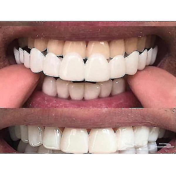 Beangle Upper/lower  Comfort Fit Flex Whitening Denture Braces Upper lower teeth