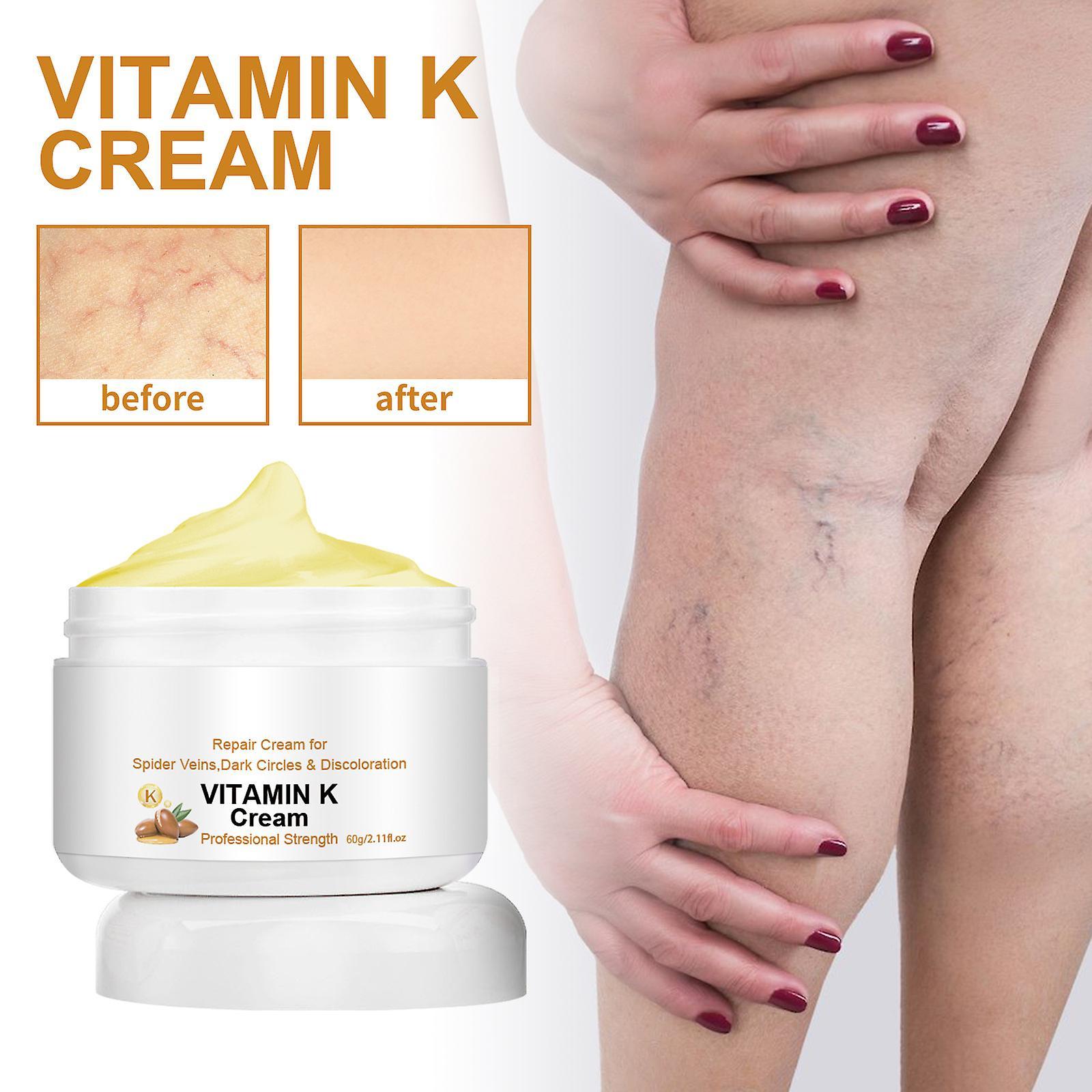 unbrand Vitamin K Cream, Repair Cream For Spider Veins, Vitamin K Varicose Veins Cream Body Spider Veins Treatment 2 pcs