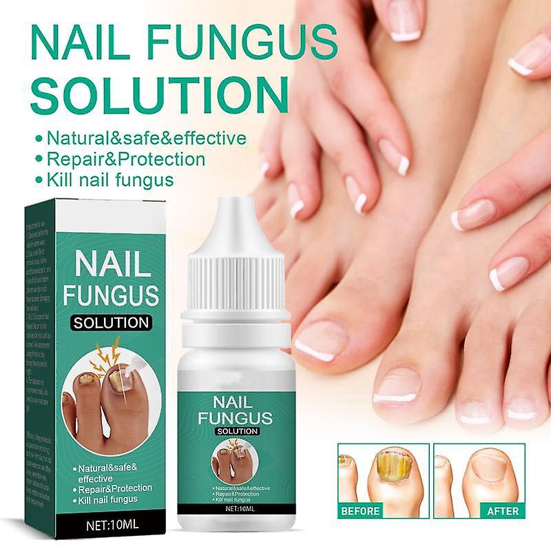 Frusde Fungal Nail Treatment For Toenail Extra Strong, Ingrown Toenail Treatment Nail Care Oils, Toenail Fungus Treatment 3Pcs