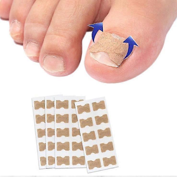 Pilk 100pcs Toenail Correction Patch Glue Free Pedicure Tools Corrector Toe Nail Ingrown Patch