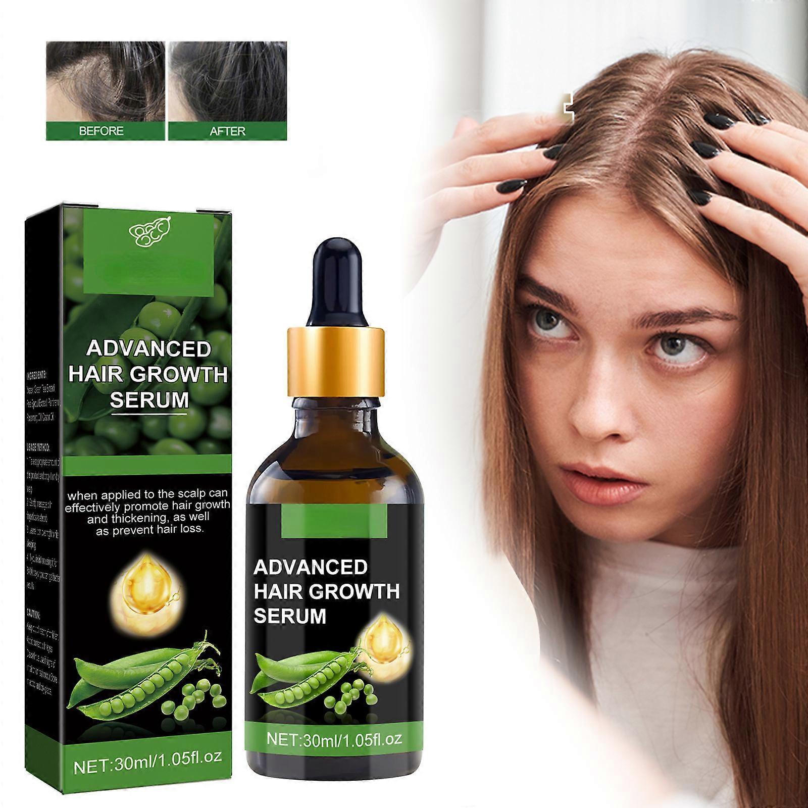 Unbrand Advanced Hair Growth Serum, Black Castor Oil for Hair Growth, Hair Regrowth Treatments, Anti Hair Loss Castor Oil for Men and Women 2pcs