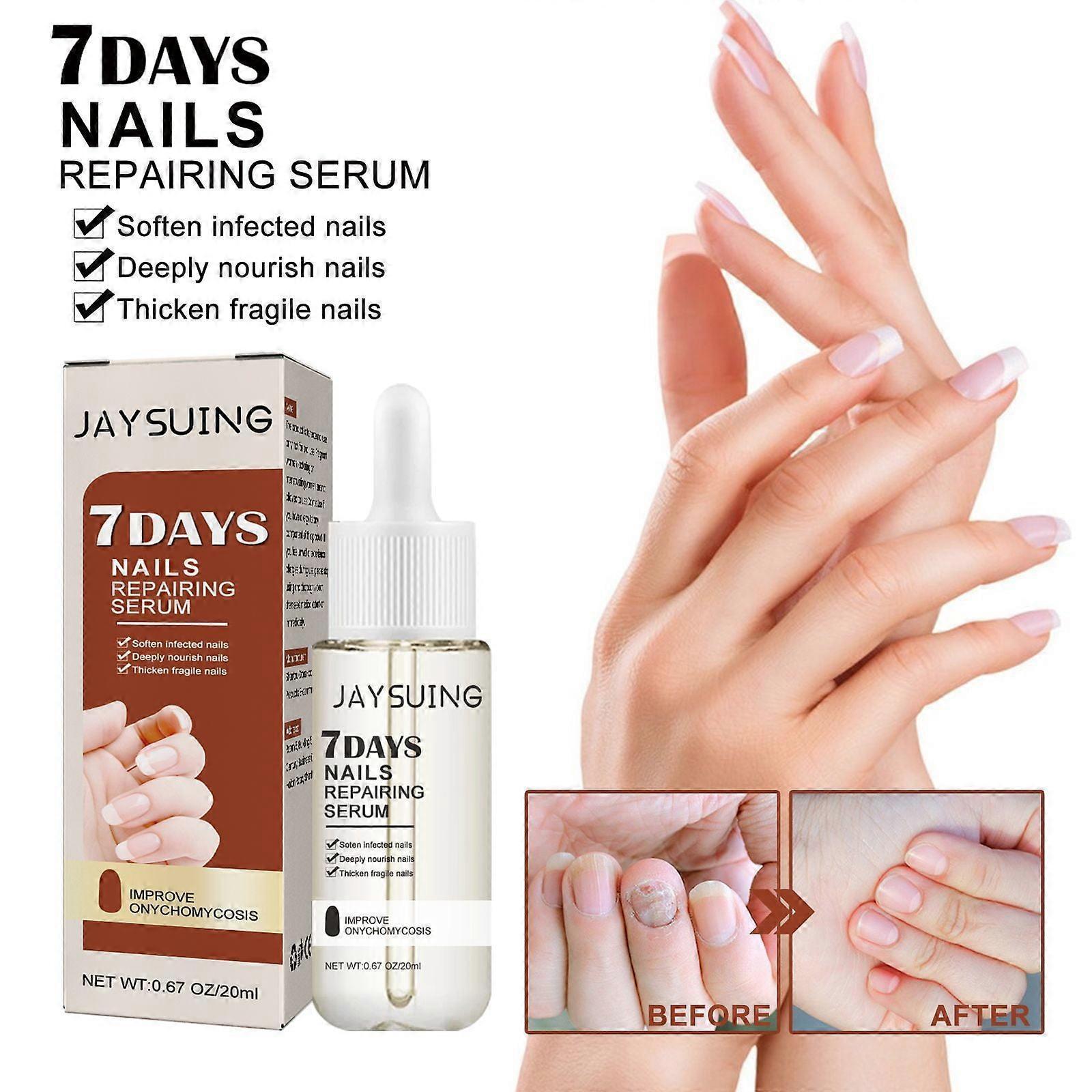 Shanxi Shuishuidiansan Trading 7 Days Nail Growth and Strengthening Serum, 7 Day Serum for Nail Growth and Strengthening, Stronger Nails in 1 Week,...