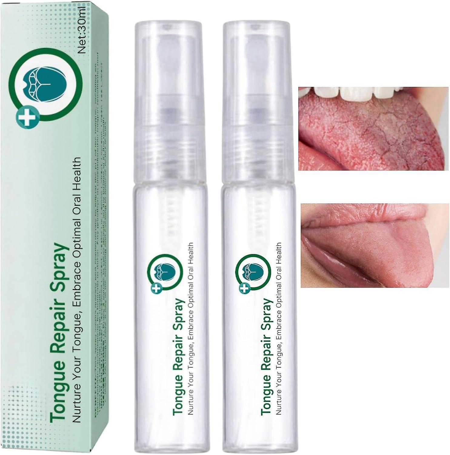 Antbaba Tongue Repair Spray for Dryness& Bad Breath,Fissured Tongue Relief Spray,Instant Dry Mouth Relief,Breath Freshener Spray 2 Pcs