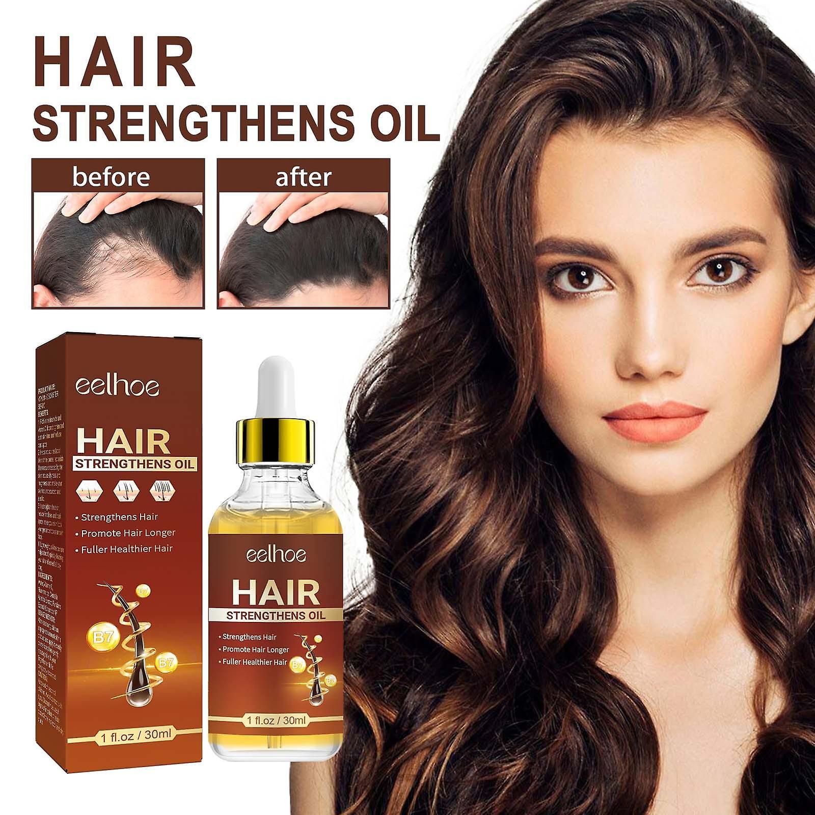 Flye 30ml Hair Growth Oil With Biotin And Castor  Hair Growth Serum For Thicker Longer Healthier Hair  Promotes Hair Regrowth  Hair Regrowth Oil 24...