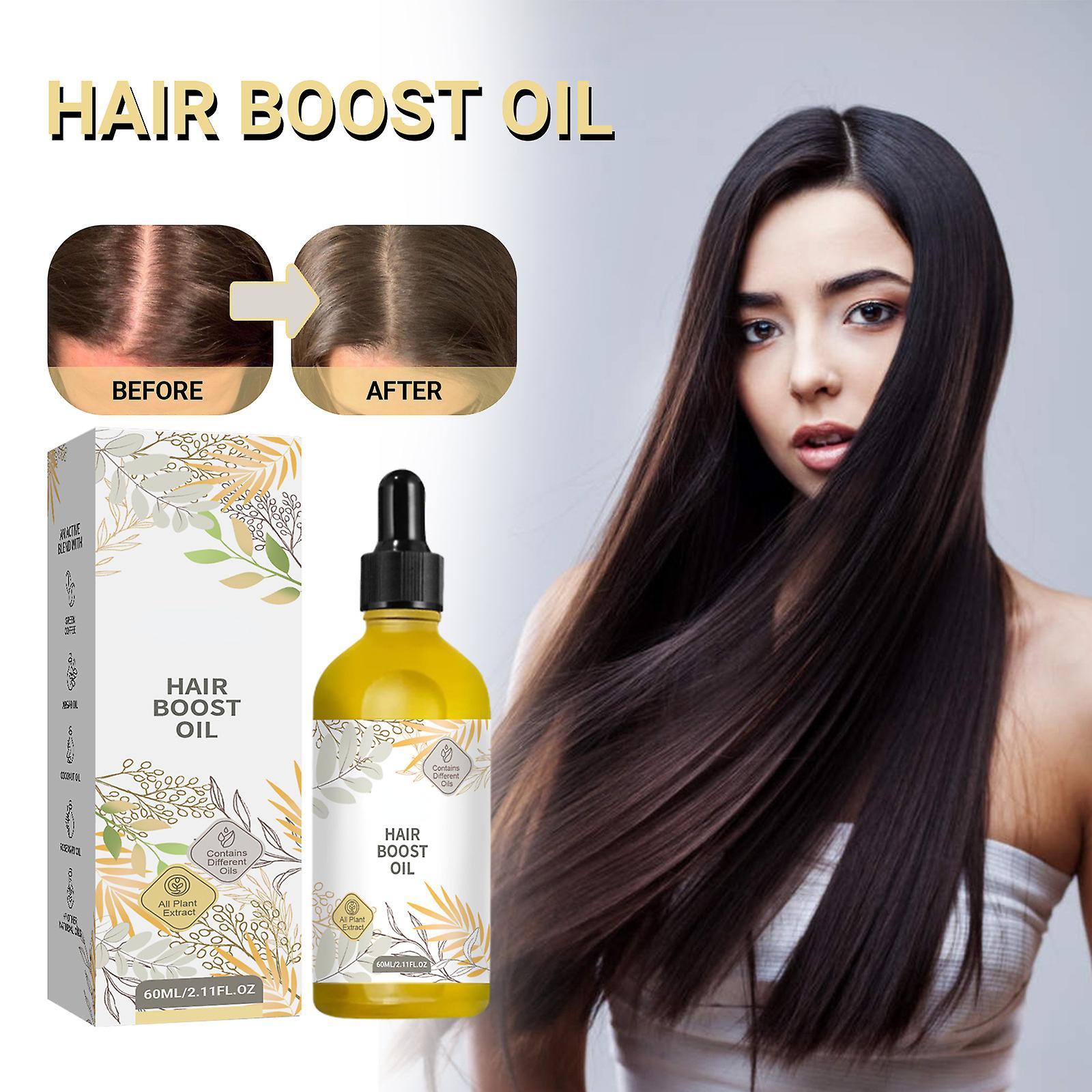 Frusde Hair Boost Oil, Hair Growth Oil, Veganic Natural Hair Growth Oil, Rosemary Oil For Hair Growth Organic Suppport Thicker Denser Fuller Lookin...