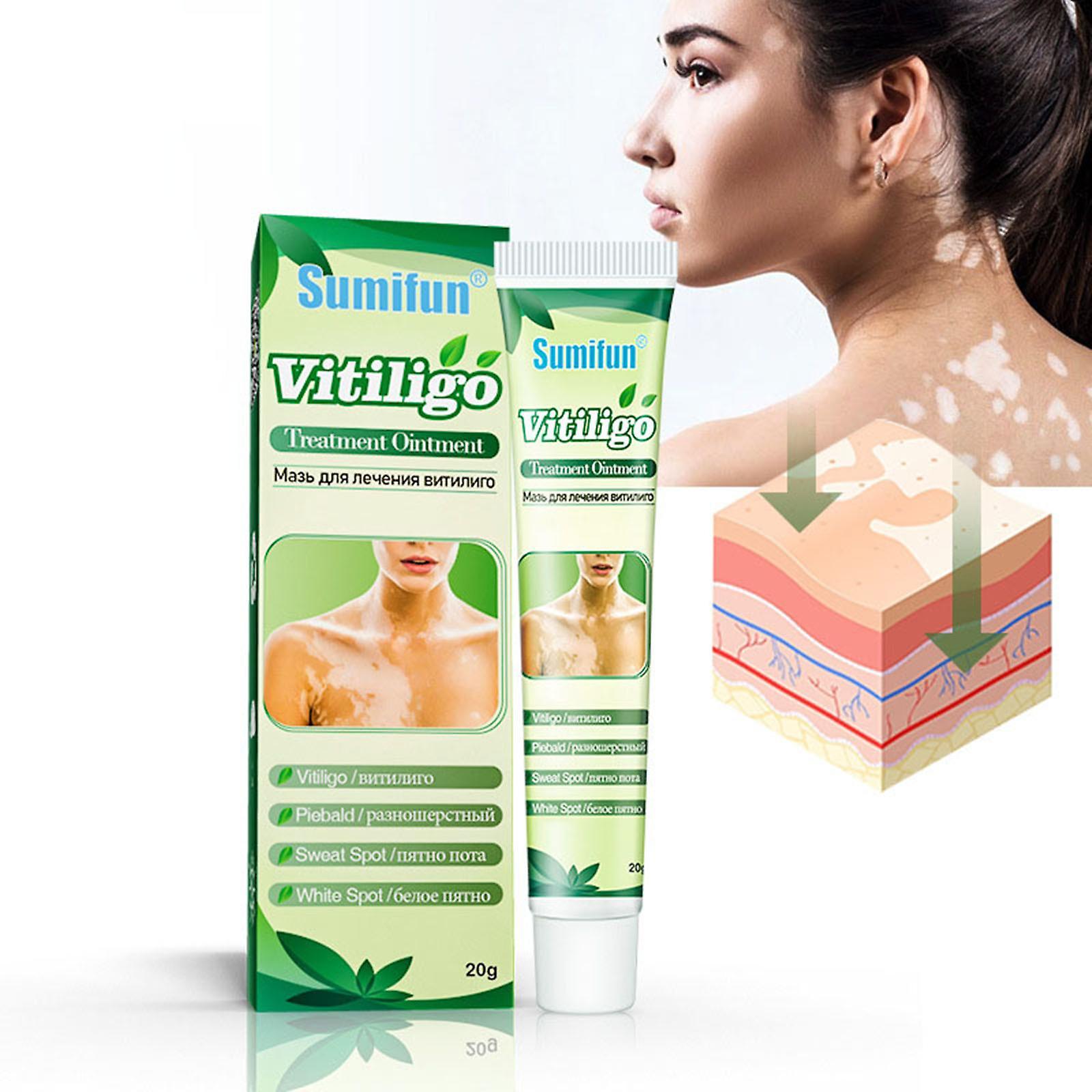 Flye 20g Adult Skin Care Moisturizing Cream Vitiligo Cream White Spots Skin Marks Green