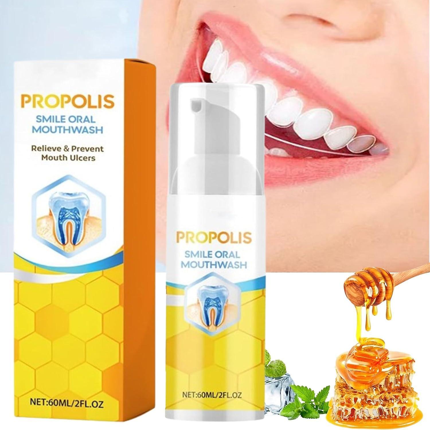 Antbaba Propolis Smile Oral Mouthwash, Bee Propolis Mouthwash, Propolis Oral Mouthwash, Mouthwash Foam, Refreshing Breath Calculus Removal Teeth Wh...