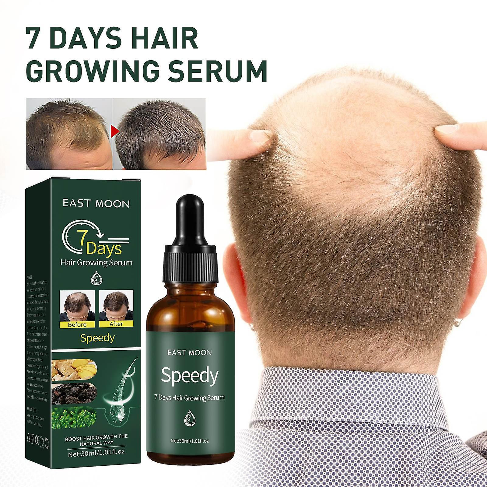 Kakanwo Hair Growth 7Days Hair Growing Serum, Anti-Detachment,Hair Development30Ml Green One Size