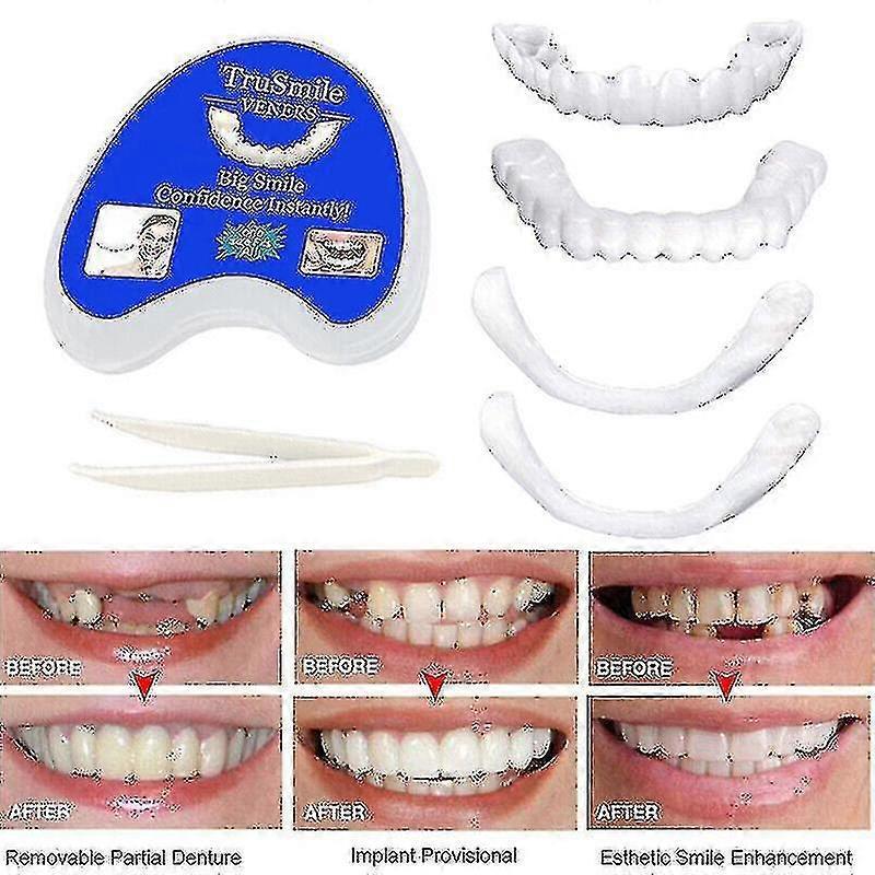 Qin Smile Snap On False Teeth Upper Lower Dental Veneers Dentures Tooth Cover Set