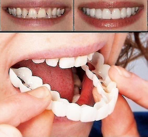 Elsavct A Pair Upper & Lower High Quality Denture Instant Smile Comfort Fit Flex Cosmetic Teeth Denture Teeth Top Cosmetic Veneer