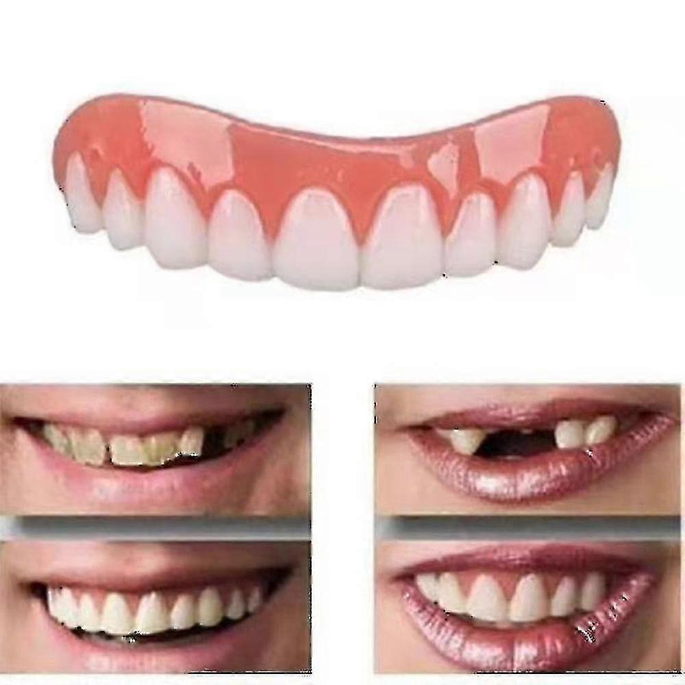 Elrachen 2 Sets Of Dentures, Upper And Lower Jaw Dentures, Natural And Comfit fortable, Protect The Teeth, And Regain A Confident Smile